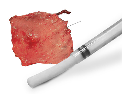 04. Rib cartilage processed as a graft materials