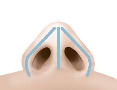 01. Before Surgery