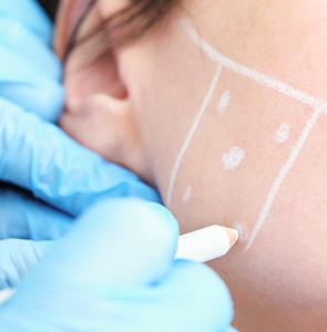 Liposuction