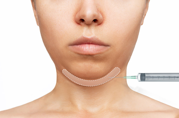 Liposuction