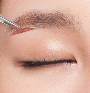 02. Skin Removal