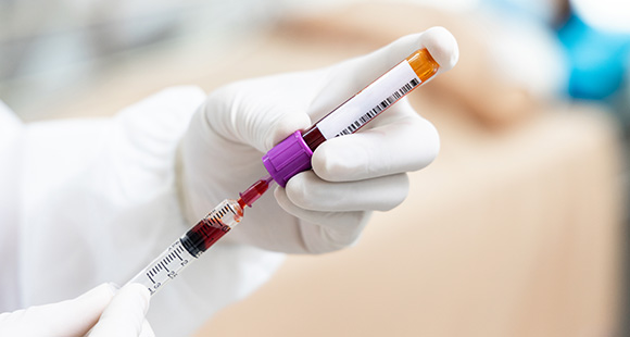 02. Blood or Fat Collection