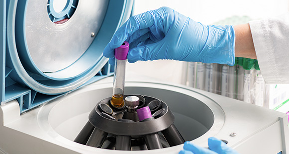03. Cell Separation and Enrichment
