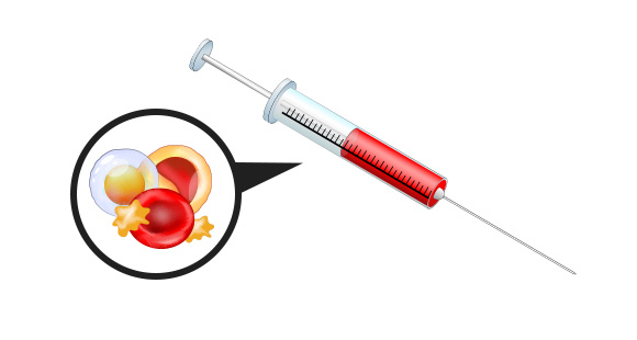Stem Cell Extraction