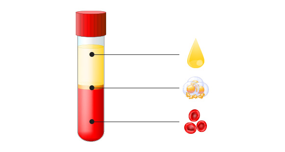 Stem Cell Separation