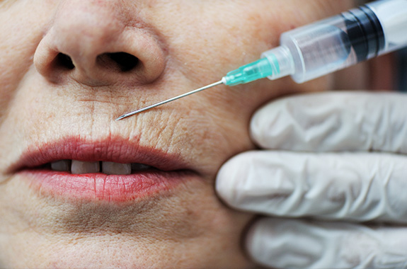 Wrinkle Botox